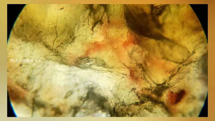 How Scabs Work and Why They Fall of on Their Own