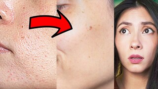 I Used Shampoo To Get Rid Of Tiny Skin Bumps