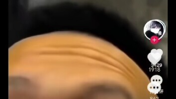 วิดีโอผิวเก่า