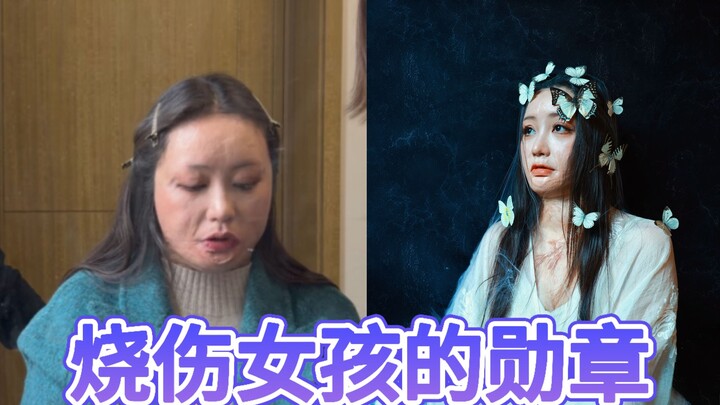 الحياة ستتركنا مثقلين بالجراح، لكن في النهاية، ما لا يقتلني سيجعلني أقوى.