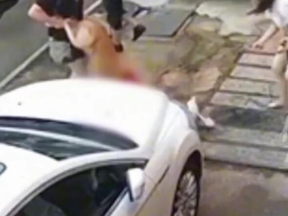 عضة الكلب للإنسان مرعبة للغاية!