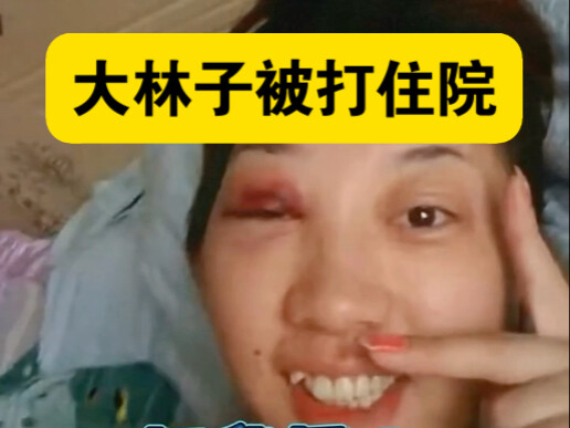 Dalinzi was beaten and hospitalized, so heartbreaking sob sob 😭