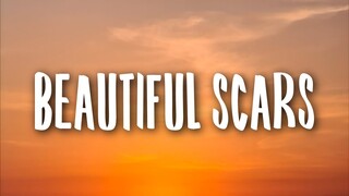 Maximillian - Beautiful Scars (Lyrics)