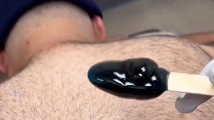 👀 Será que você consegue assistir esse procedimento sem chegar até o final? Eu duvido! 😍