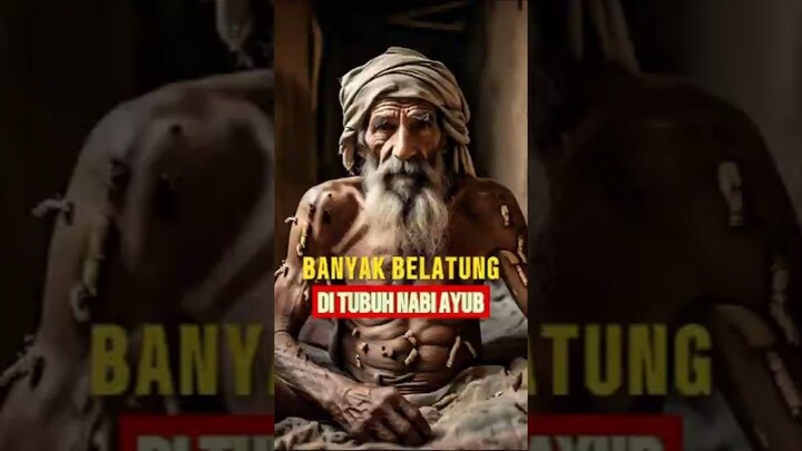 NABI AYUB DIUJI ALLAH PENYAKIT KULIT #shortsvideo #youtubeshorts #nabiayub