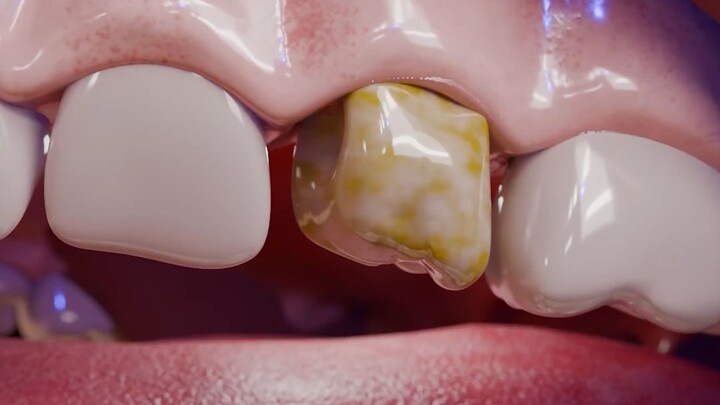 Smart Teeth
