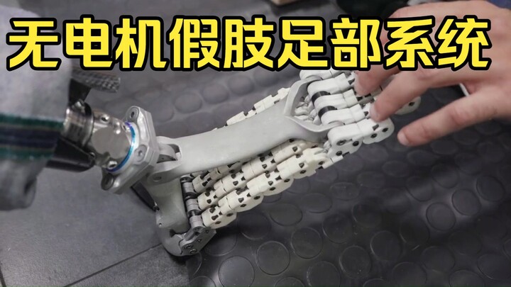 Is This the Prosthesis of the Future? Italy’s Motor-Free Artificial Foot System