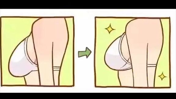 breast lift exercise