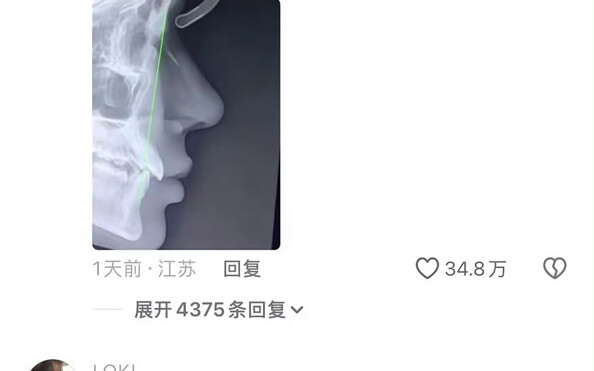 ในช่องคอมเมนต์ไม่มีใครเป็นห่วงผู้เขียนเลย ทุกคนล้วนแต่ทึ่งในงานโมเดลลิ่งกันหมด