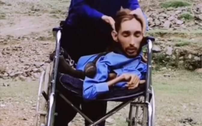 Hanya kepalanya yang tampak normal… Hargai setiap hari yang kamu miliki sekarang.