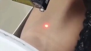 جهاز جمع الدم أوتوماتيكي بالكامل
