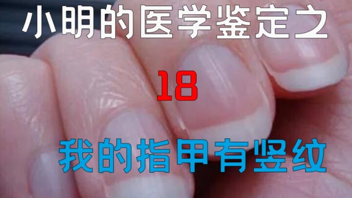 【Giám định y học】 Giám định video y học đang hot trên mạng 18