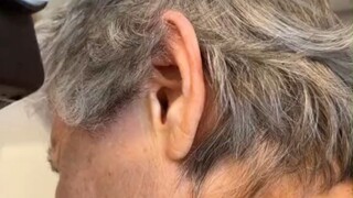 老奶奶总觉得耳朵里有东西在动，果然...可怕的体验增加了！