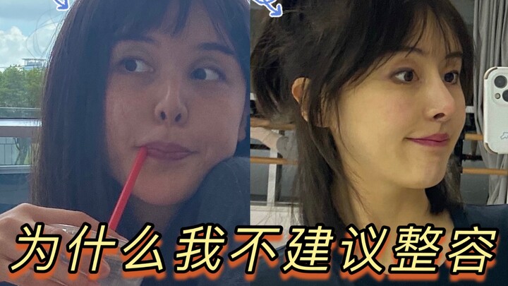 Tại sao tôi không khuyên bạn phẫu thuật thẩm mỹ