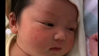 人类幼崽的双眼皮进化史～