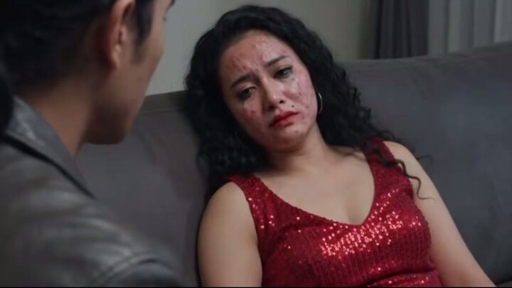 Wajah biduan nomor satu mendadak hancur melepuh part 2