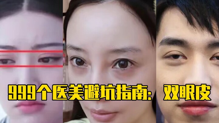 999 Y Beauty Pitfall Guide: Double Eyelids