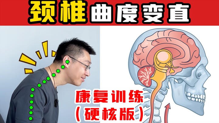 【Doktor Pasca-doktoral Chiropraktik Milik Juara Olimpiade】Latihan Rehabilitasi untuk Kelurusan Kurva