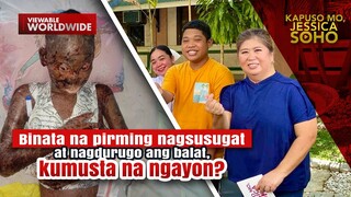 Binata na pirming nagsusugat ang balat, tuluyan nang nagbago ang buhay | Kapuso Mo, Jessica Soho