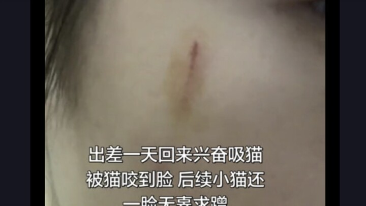 Người Haki đáng thương này