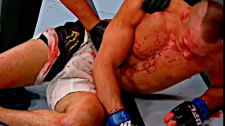 Trận chiến này đã vĩnh viễn thay đổi anh ấy