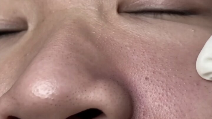 Cần chú ý vệ sinh da mặt nhé