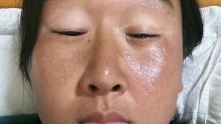 10 Years of Whale-Watching Around the Globe—and I’m This Tanned | Can You Spare 30 Seconds to Check 