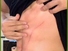 老公们还是要注意安全！！川体吴尊男大学生擦边时被瓶盖划伤！！！