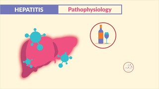 Hepatitis