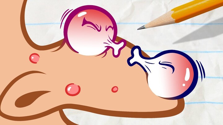Pencilmate's POPS a Pimple! | Animated Cartoons Characters | Animated Short Films