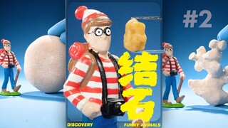 人体内的结石居然可以长这么大🙀