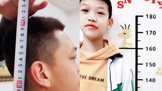 12岁男孩净身高达195厘米，医院检查骨龄瞬间惊呆医生：第一次见