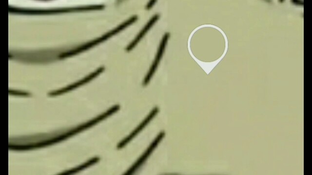 Obito ลบรอยแผลเป็นอย่างไร