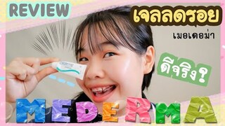 รีวิว MEDERMA เจลลดรอยสิว หลังใช้ รู้สึกอย่างไร เเล้วทำไมถึงเลิกใช้ I Ikziice