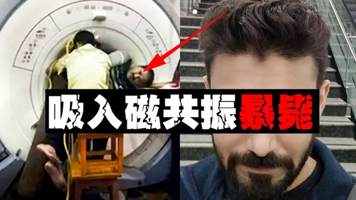 [Inhalation MRI] A man was killed after his lungs exploded after inhaling for a second.