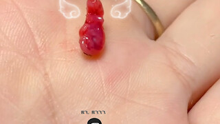 تغيرات صغير الأنف يا!