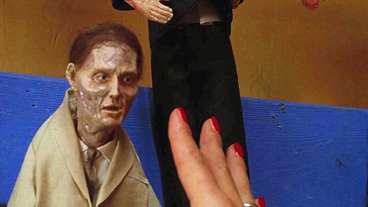 Si gemuk disentuh sekali oleh seorang kakek, langsung mulai kurus drastis dari berat 150 kg hingga a