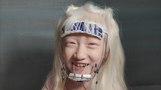 医生说，你针线好的话，自己缝合固定一下吧！结果，糖糖说，妈妈，你怎么缝那么久，这...是蜘蛛网啊