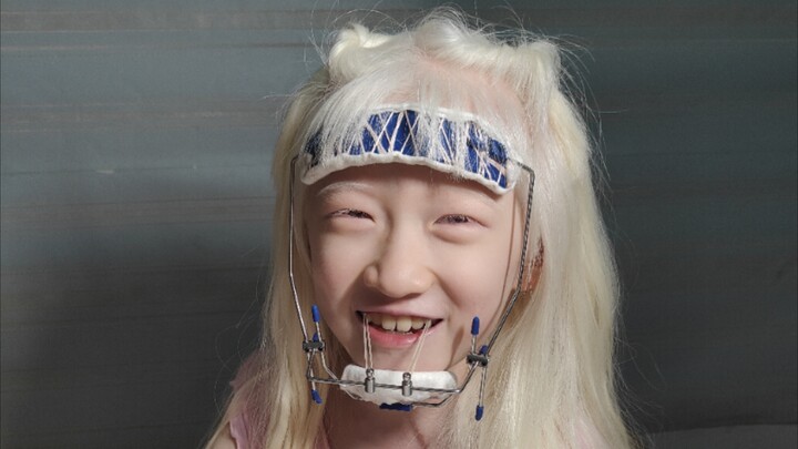 医生说，你针线好的话，自己缝合固定一下吧！结果，糖糖说，妈妈，你怎么缝那么久，这...是蜘蛛网啊