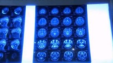 1 litter of tears ep1 tagalog