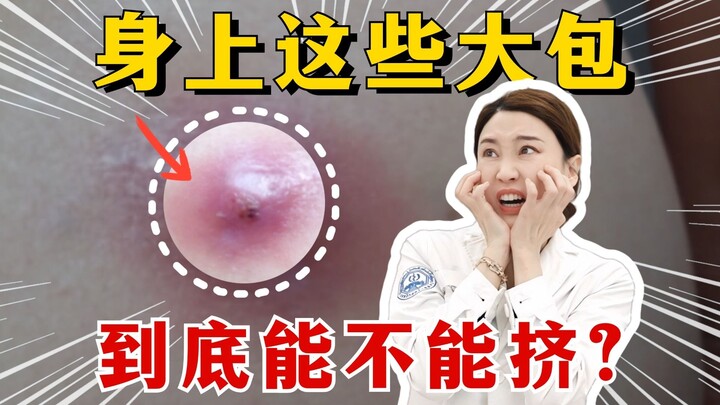 身上哪些包能挤，哪些不能挤，一个视频讲清楚！