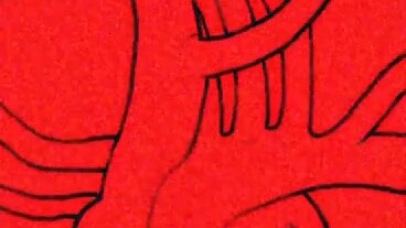 ฟลูออกซีทีน ไฮโดรคลอไรด์