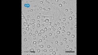 Time lapse of HepG2 self-assembly into multicellular spheroids - CytoSMART Lux2