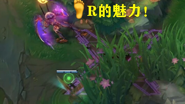 The charm of foot R