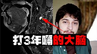 【寄生嗝瘤】每两秒打一次嗝，把人打废掉