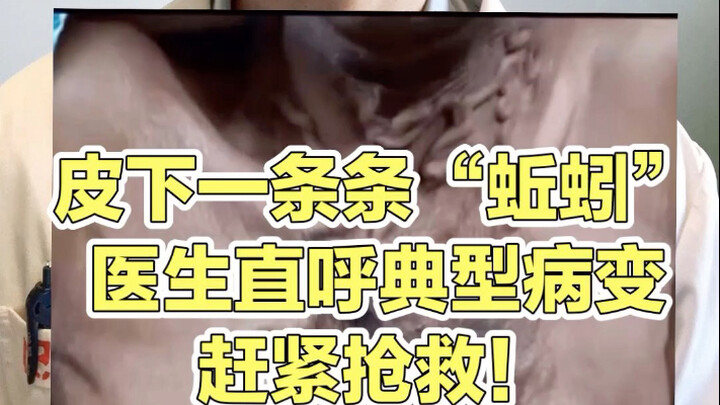 Merokok dapat menyebabkan konsekuensi serius. Segera cari pertolongan medis. Pemutih akan segera mun