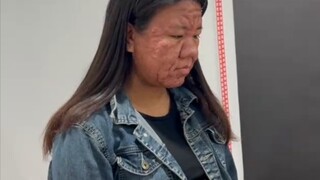 الفرق بين ما قبل وما بعد الحمل