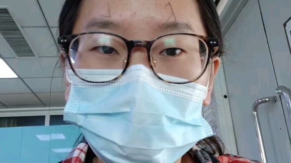 Cắt mí đôi toàn phần + mở góc mắt, tôi hối hận rồi... Hối hận vì không làm sớm hơn, nhật ký 2 tháng 