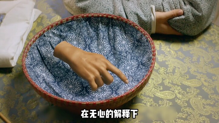 ชายถูกทำร้ายจนเหลือเพียงมือเดียว แต่ยังสามารถฟื้นคืนชีพได้