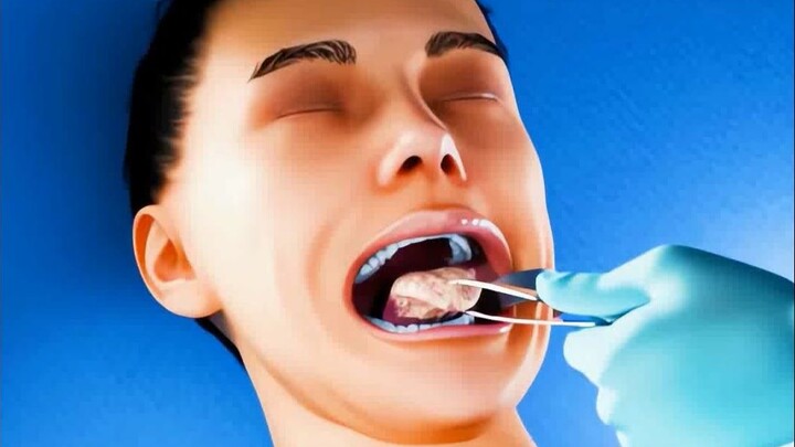 Her tongue was cut off and a piece of flesh was grafted onto it.